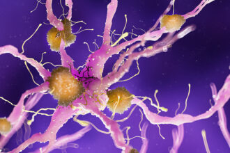 beta amyloid